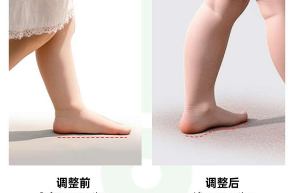 芯迈儿童步态调整与纠正解决方案，应对国内儿童足部问题挑战